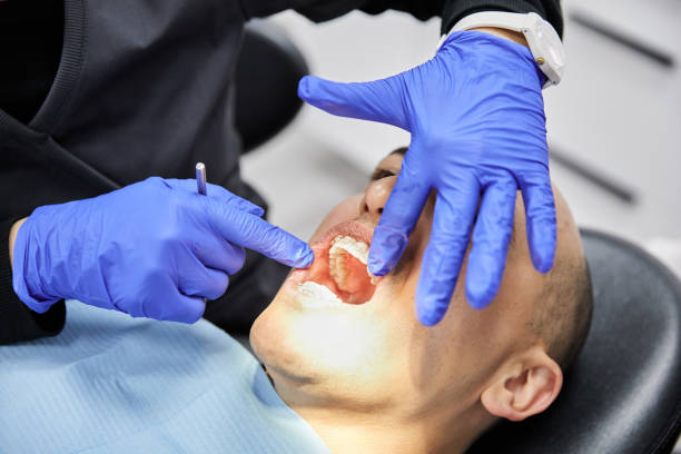 Best Knocked-Out Tooth Emergency  in Mingo Junction, OH